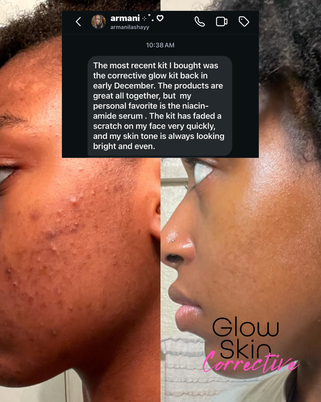 Niacinamide Serum
