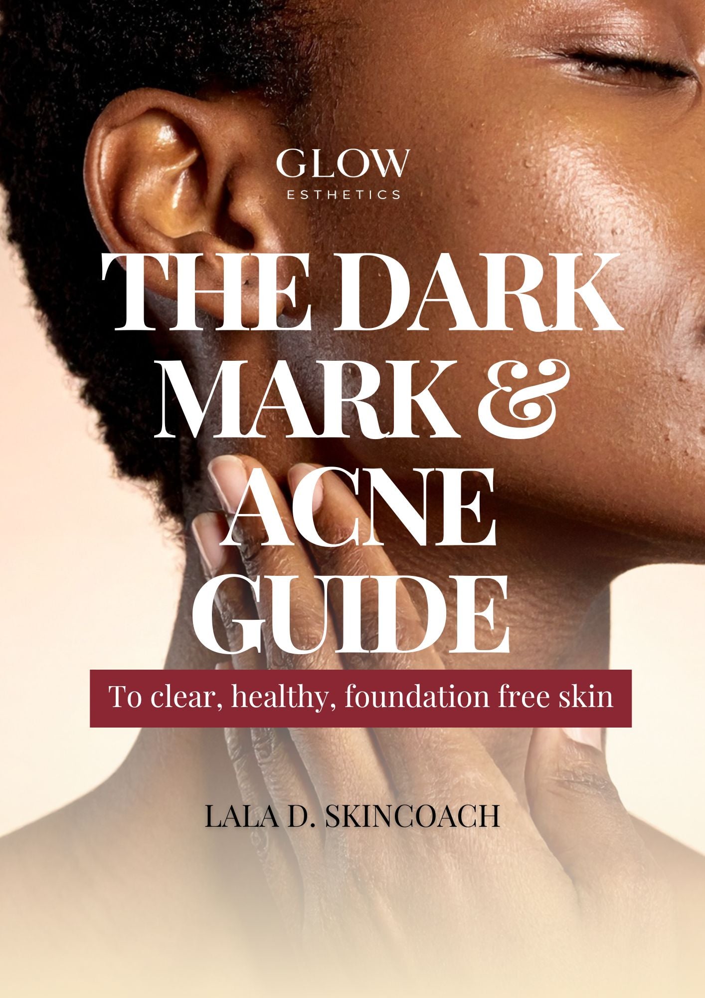 The Dark Mark & Acne Guide