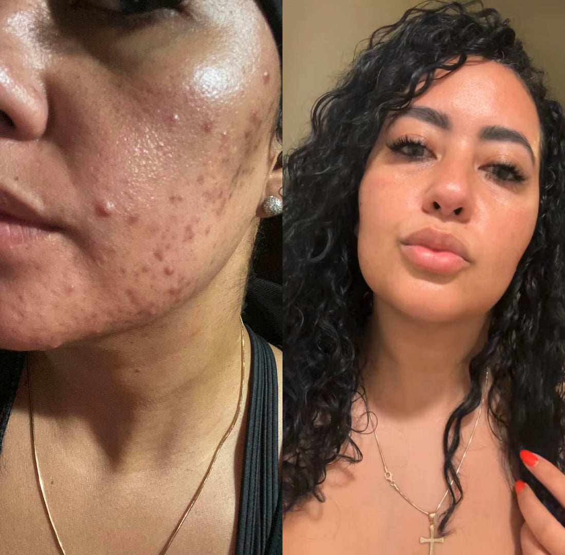 Corrective Glow Kit