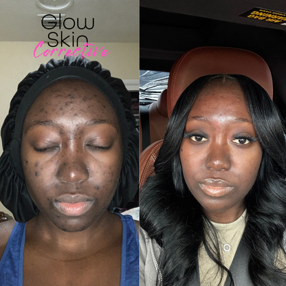 Corrective Glow Kit